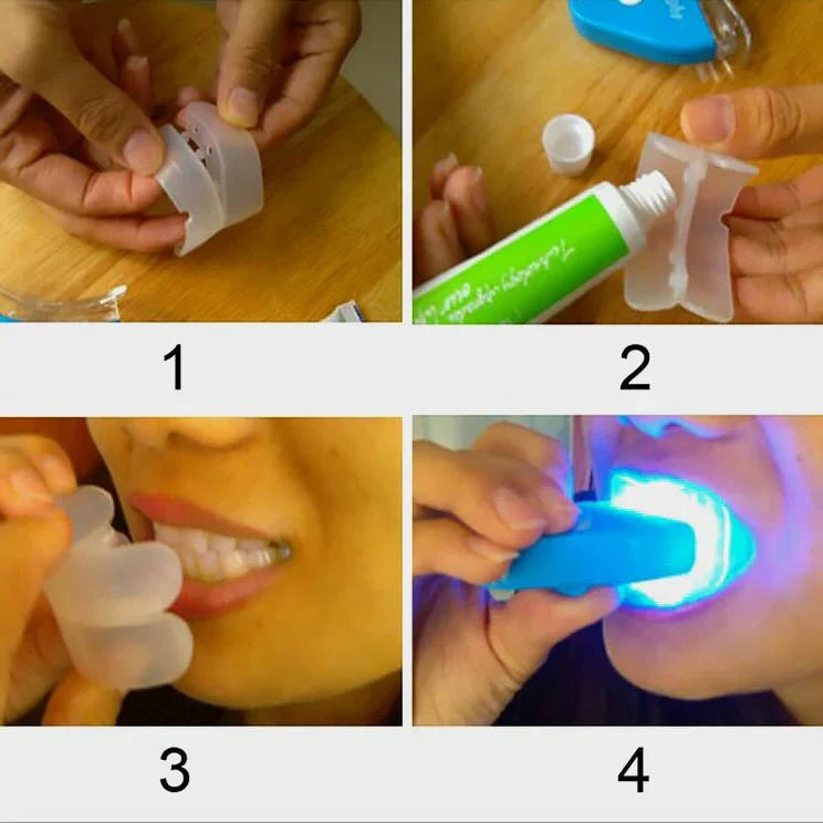 LED Teeth Whitening Kit – At-Home Blue Light Whitening System with Gel & Mouth Tray